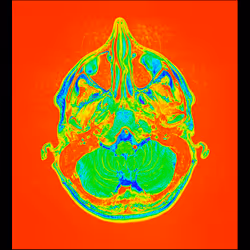 64162533542198579898252916190583583845604629893829087458582975807365157224449