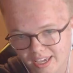 MrTLexify Forehad #2