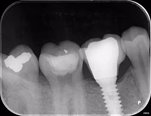 Item #11780915356901891937150191052604117223978980698243640119023280902561750581249 Media