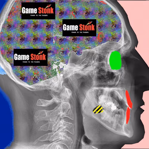 RX SKULL #10 GAMESTONK THINKER
