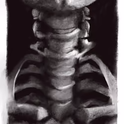 Study #15