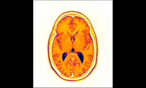 Item #64162533542198579898252916190583583845604629893829087458582976577023296667649 Media