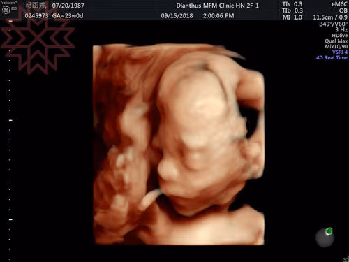 Item #105322358618701185533743754469895824107639028648078310589264470463091969097729 Media