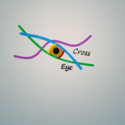 Cross Eye