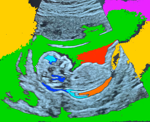 Item #71588266468728831703573745237566796284663219565327955974813494209994786078721 Media