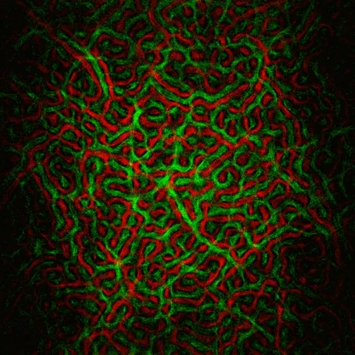 Physarum #212