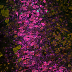 Neurons #20 Pink