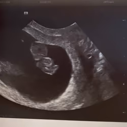 unborn florida baby 