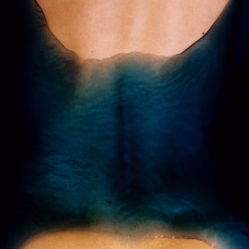 Vulnerability