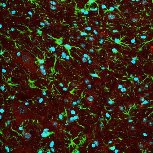 Item #56093845266365580198989074568914204894151473020386784908679452218015086542849 Media