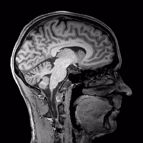 Brainybrains
