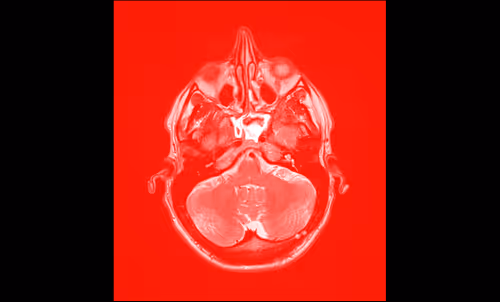 Item #64162533542198579898252916190583583845604629893829087458582975912918273490945 Media