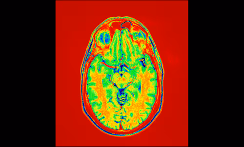 Item #64162533542198579898252916190583583845604629893829087458582976372514133901313 Media