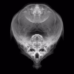 Alien Embryo - 438 of 2000