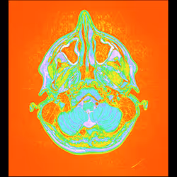 64162533542198579898252916190583583845604629893829087458582975673224738635777