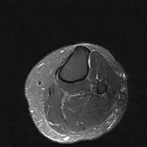 Item #11780915356901891937150191052604117223978980698243640119023280892666145931265 Media