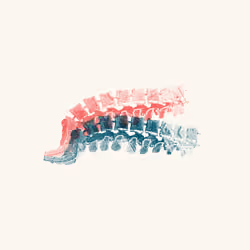 Millipede 