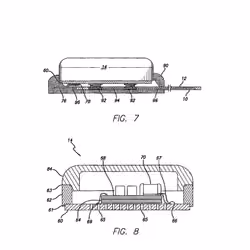 US8527057 - Bionic Eye