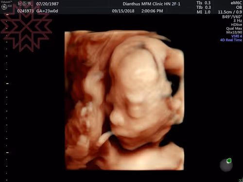 Item #105322358618701185533743754469895824107639028648078310589264470463091969097729 Media