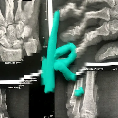 Item #42502377884493822439484110895335049498054174976923948741203377809771158568961 Media