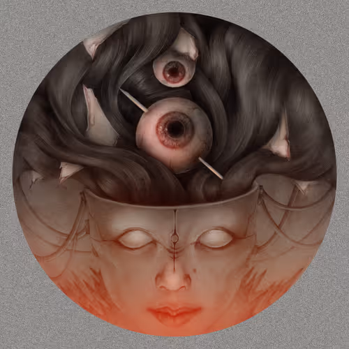 Migraine