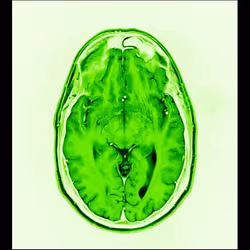 64162533542198579898252916190583583845604629893829087458582976418693622267905