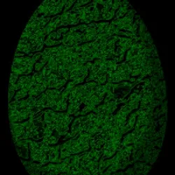 Strange Egg #98