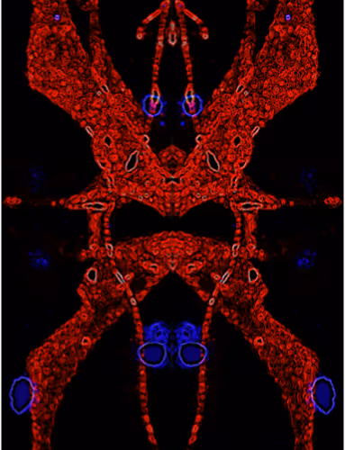 Worm Brains