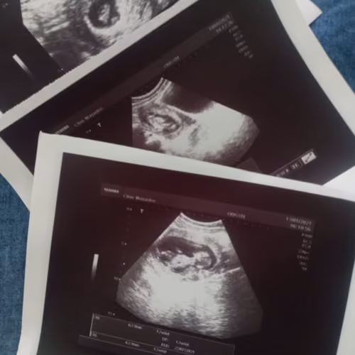 baby ultrasound