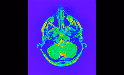 Item #64162533542198579898252916190583583845604629893829087458582975806265645596673 Media