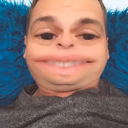  stage 5