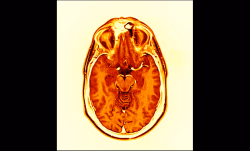 Item #64162533542198579898252916190583583845604629893829087458582976308742459490305 Media