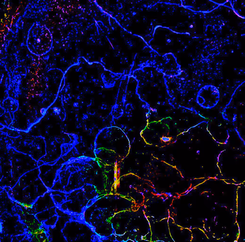 Item #72256936060036278923331537561005506622264708892264959040134690058648225316865 Media