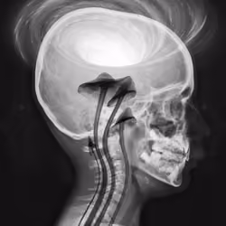 X-RAY #11