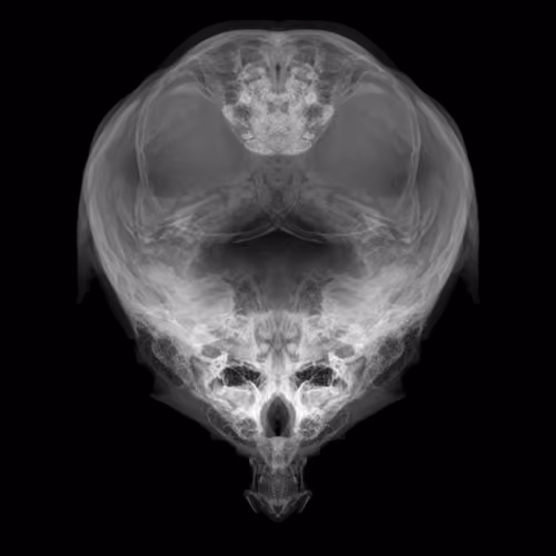 Alien Embryo - 418 of 2000