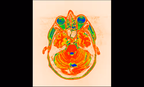 Item #64162533542198579898252916190583583845604629893829087458582976088840133935105 Media