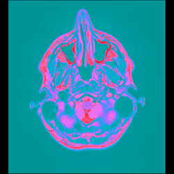 64162533542198579898252916190583583845604629893829087458582975623746715385857