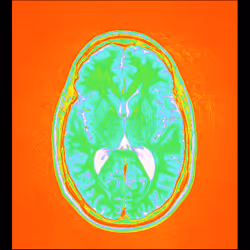 64162533542198579898252916190583583845604629893829087458582976588018412945409