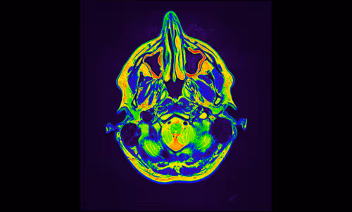 Item #64162533542198579898252916190583583845604629893829087458582975636940854919169 Media