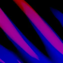# Patterns Pinkish
