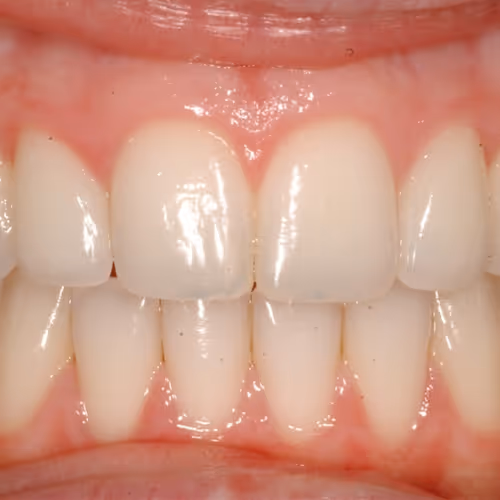 Nfteeth V2