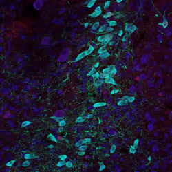 Neurons #17