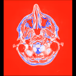 64162533542198579898252916190583583845604629893829087458582975642438413058049