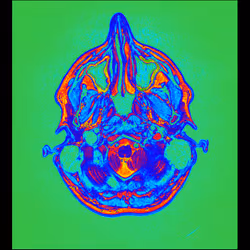 64162533542198579898252916190583583845604629893829087458582975599557459574785