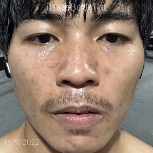 Item #108313735065530085494104811663089913935582935953301802110046719378799200305153 Media