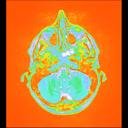 64162533542198579898252916190583583845604629893829087458582975844748552568833