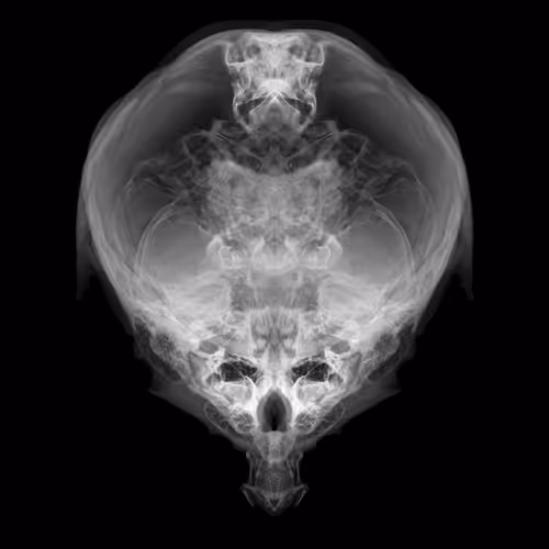 Item #85859191866638808365331437874953228966785819470149775310971061870634156949505 Media