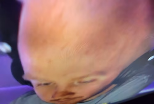 TimTheTatMan FAT Head