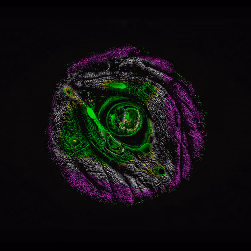 Eye #81