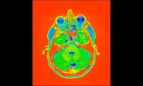 Item #64162533542198579898252916190583583845604629893829087458582976036063575801857 Media